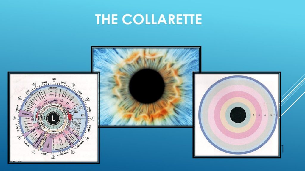 The Collarette SIBO ENS Iridology Course